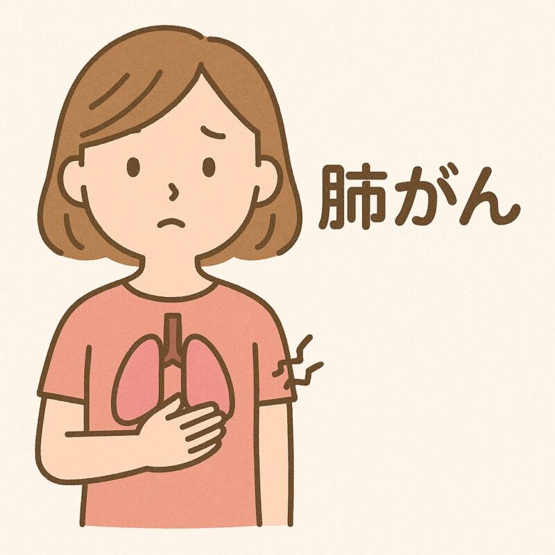 肺がん